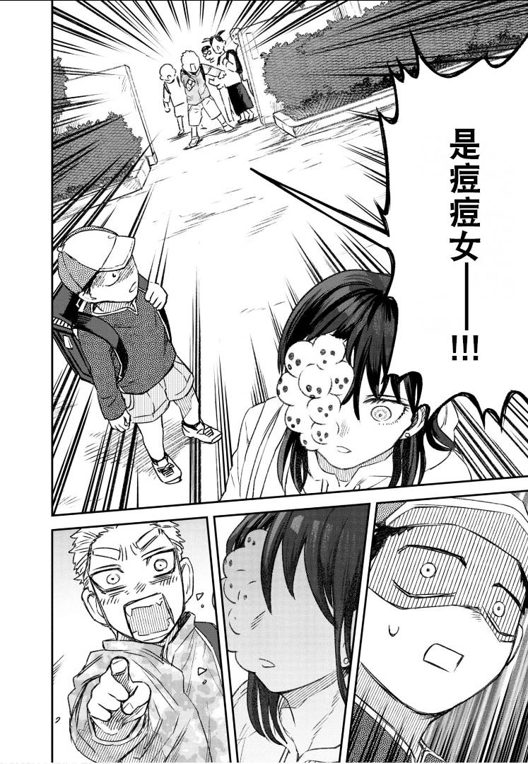 面长疮怎么消除漫画,第58话3图